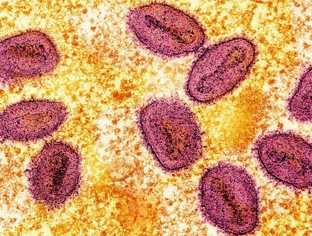 Morocco confirms first Mpox case