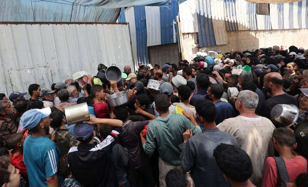 Surgeon says Gaza patients die from wounds because of starvation Surgeon says Gaza patients die from wounds because of starvation
