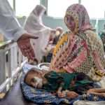 UN agency warns of child malnutrition spike in Afghanistan
