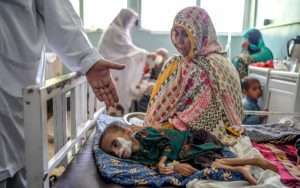 UN agency warns of child malnutrition spike in Afghanistan