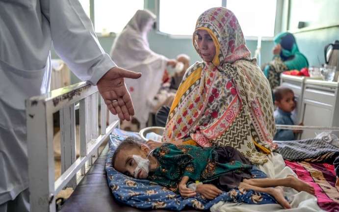 UN agency warns of child malnutrition spike in Afghanistan UN agency warns of child malnutrition spike in Afghanistan